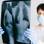 Nový lék zdvojnásobil délu přežití u rakoviny slinivky: medián 13,2 měsíce 8