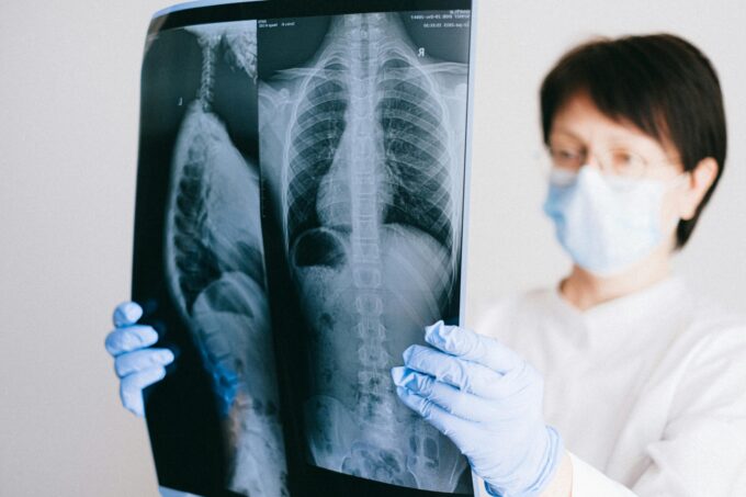 Nový lék zdvojnásobil délu přežití u rakoviny slinivky: medián 13,2 měsíce 10