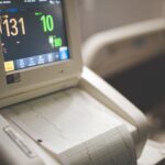 ekg