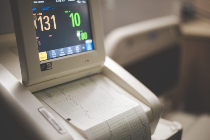 ekg